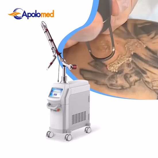 ND YAG 1064 nm Lasergerät zur Tattooentfernung zur Hautverjüngung